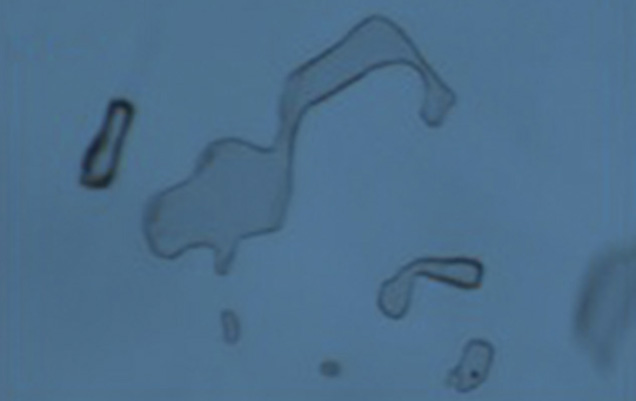 HOC synthetic alexandrite inclusion.. K. Schmetzer, H.-J. Bernhardt, W. A. Balmer, and T. Hainschwang. “Synthetic alexandrites grown by the HOC method in Russia: Internal features related to the growth technique and colorimetric investigation,” Journal of Gemmology, Vol. 33, No. 5–6, 2013, pp. 113–129. Photo courtesy of Karl Schmetzer.