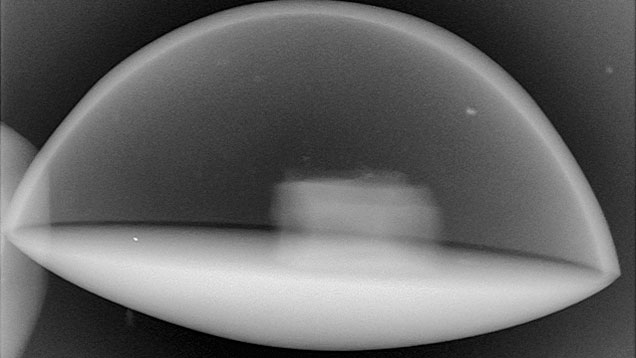 F15-LN-Figure-18_191031-636x358.jpg. The microradiograph revealed an internal component.