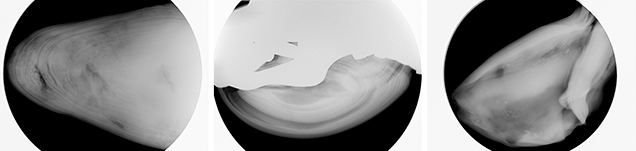 Concentric and void-related internal structures typical of abalone pearls. Concentric and void-related internal structures typical of abalone pearls.