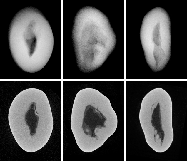 RTX and μ-CT images for a non-bead-cultured pearl. Figure 8. The RTX (top row) and μ-CT (bottom row) images for a non-bead-cultured pearl (sample 0668689302). The RTX images show the whole thickness of the pearl in each orientation, while each μ-CT image shows a micron-thin slice of the structure in each of the directions. This demonstrates the difference between the two types of X-ray techniques.