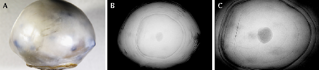 Microradiographs reveal pearl’s natural internal structure.
