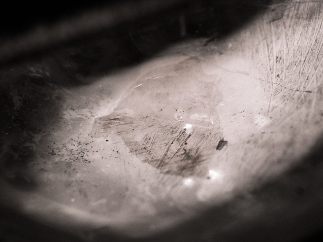 Large cavity filling under reflected illumination.