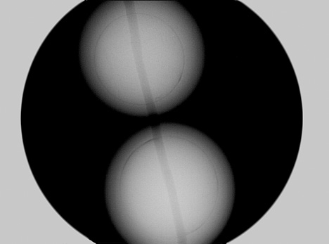 SU15-LN-Figure-12_185193-468x347.jpg. X-ray of Chinese bead-cultured pearl