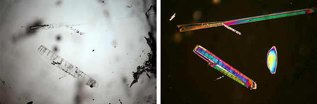 Amphibole inclusions in rock crystal quartz, observed in transmitted light and polarized light. Amphibole inclusions in rock crystal quartz, observed in transmitted light and polarized light.