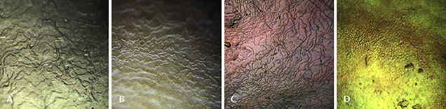 Surface nacreous structure of Kasumiga pearls Surface nacreous structure of Kasumiga pearls