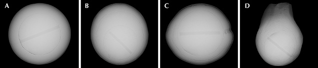 Microradiographs of undrilled shell-nucleated cultured pearls from Lake Kasumigaura Microradiographs of undrilled shell-nucleated cultured pearls from Lake Kasumigaura