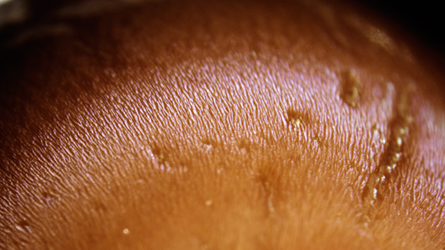 Bluish flame structures on non-nacreous pearl. Bluish flame structures on non-nacreous pearl.