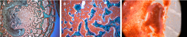 Figure 15. A and B: Microscopic images of the reddish brown fixation layer on the glass substrate of the lidded goblet in Munich showing flow structures. C: Within the groundmass of lead glass, small hematite particles are finely dispersed. Photomicrographs by H.-J. Ranz; fields of view 3.5 mm (A), 0.9 mm (B), and 1.8 mm (C). Figure 15. A and B: Microscopic images of the reddish brown fixation layer on the glass substrate of the lidded goblet in Munich showing flow structures. C: Within the groundmass of lead glass, small hematite particles are finely dispersed. Photomicrographs by H.-J. Ranz; fields of view 3.5 mm (A), 0.9 mm (B), and 1.8 mm (C).