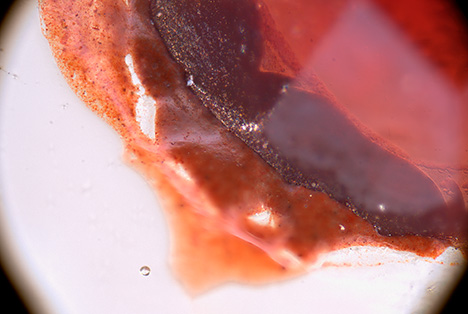 Figure 16. Decorative Bohemian garnet fixed to the colorless glass substrate of the lidded goblet in Munich. The reddish brown fixation layer is found in the gap between the garnet and the glass substrate, but also on the glass substrate outside of the garnet. Photomicrograph by H.-J. Ranz; field of view 4.47 mm. Figure 16. Decorative Bohemian garnet fixed to the colorless glass substrate of the lidded goblet in Munich. The reddish brown fixation layer is found in the gap between the garnet and the glass substrate, but also on the glass substrate outside of the garnet. Photomicrograph by H.-J. Ranz; field of view 4.47 mm.